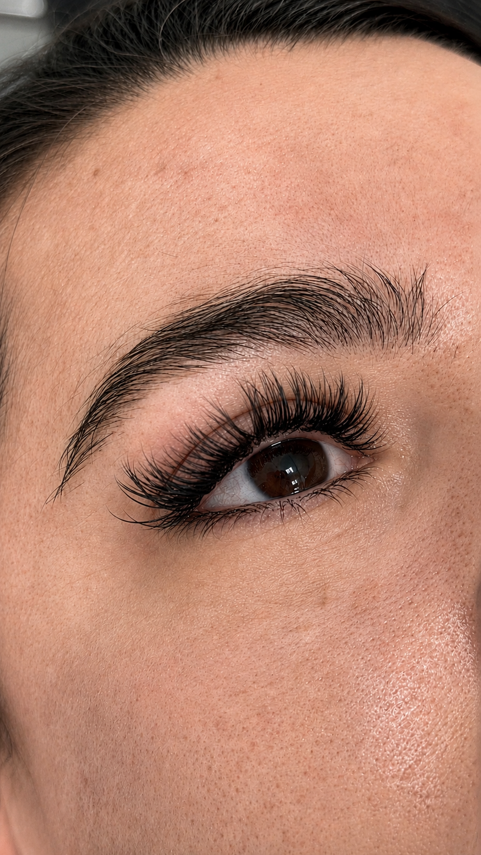 LumiSkin treatment result